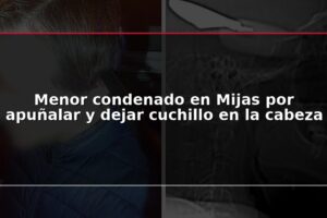 Menor condenado en Mijas por apuñalar y dejar cuchillo en la cabeza