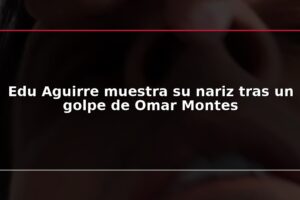Edu Aguirre muestra su nariz tras un golpe de Omar Montes