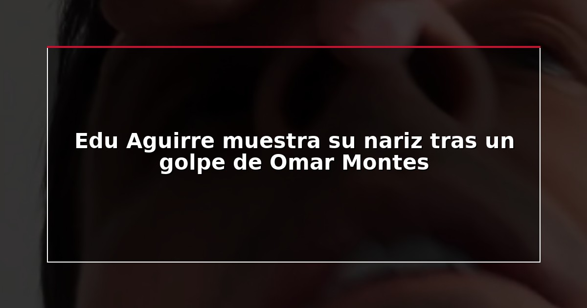 Edu Aguirre muestra su nariz tras un golpe de Omar Montes