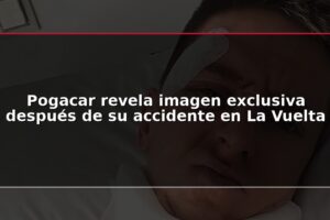 Pogacar revela imagen exclusiva después de su accidente en La Vuelta